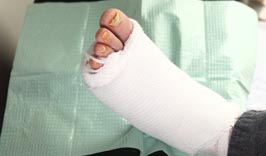 Podiatric Sports Medicine